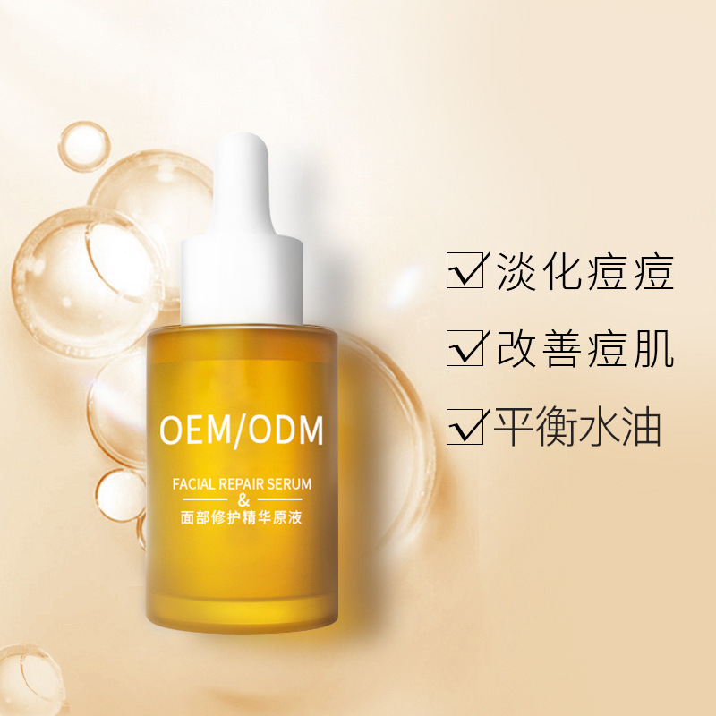大兴区_祛痘精华原液OEM